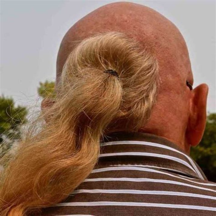 Embracing The Bald Guy With Ponytail Trend