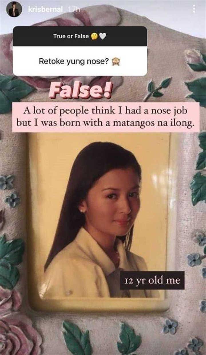 Kris Bernal Shuts Down Nose Job Speculations